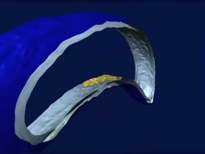 C. crescentus Cytoskeleton