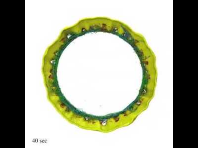 Simulations of the actomyosin ring