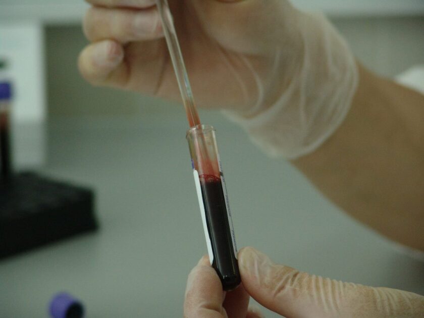 blood-20745_1920-1080x810.jpg