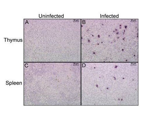 HIV-Infected-ss.jpg