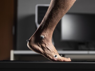 Image of Foot Monitoring