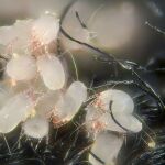 Dust mites on carpet fibers.
