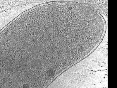 Type VI Secretion System